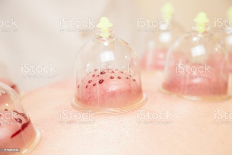 istockphoto-1326675234-1024x1024